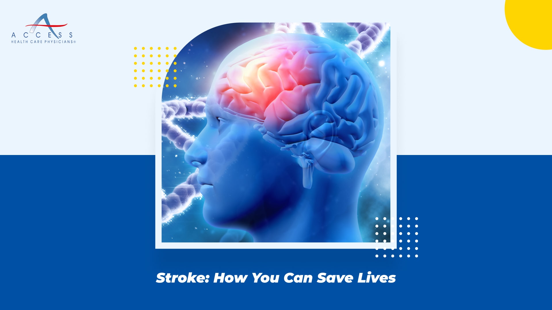 Stroke: How You Can Save Lives
