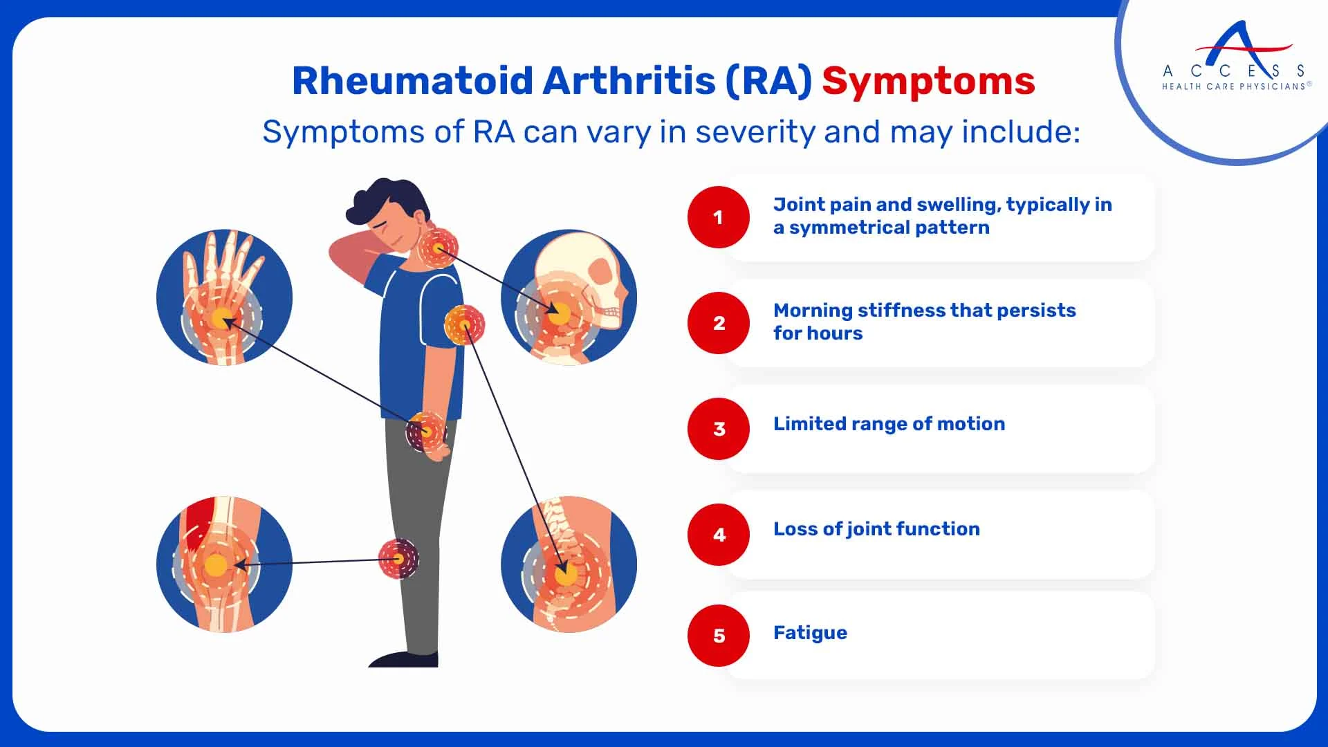 Rheumatoid-Arthritis-(RA)-Symptoms