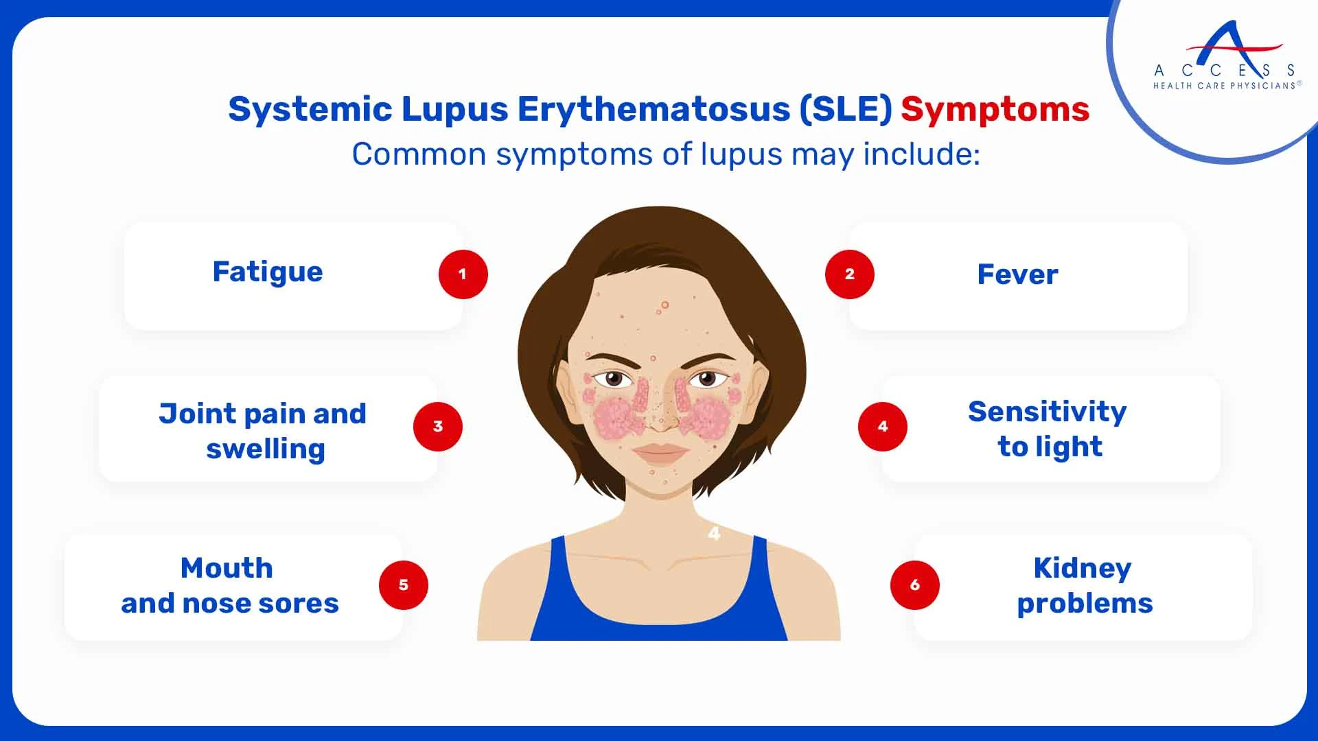 Symptoms-of-Lupus