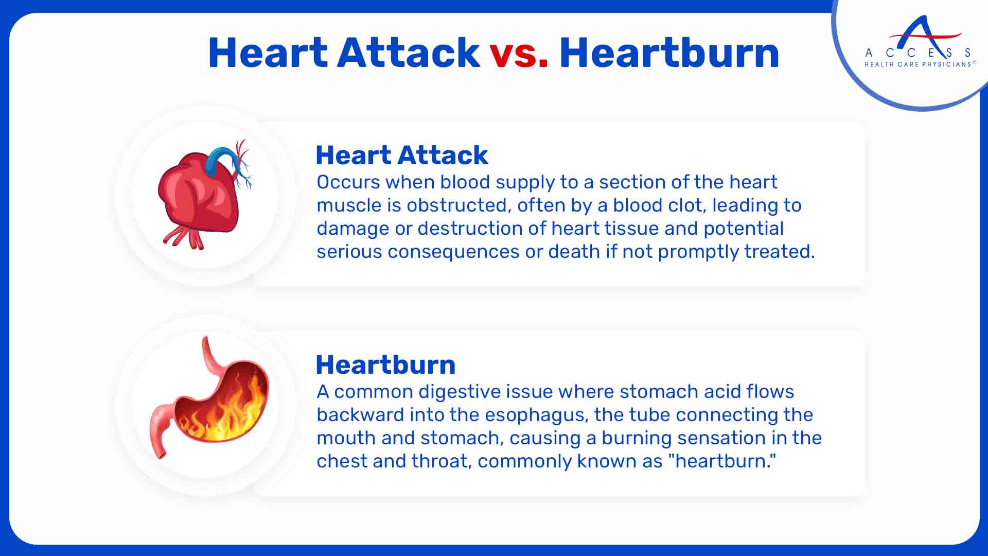 Heart Attack vs. Heartburn