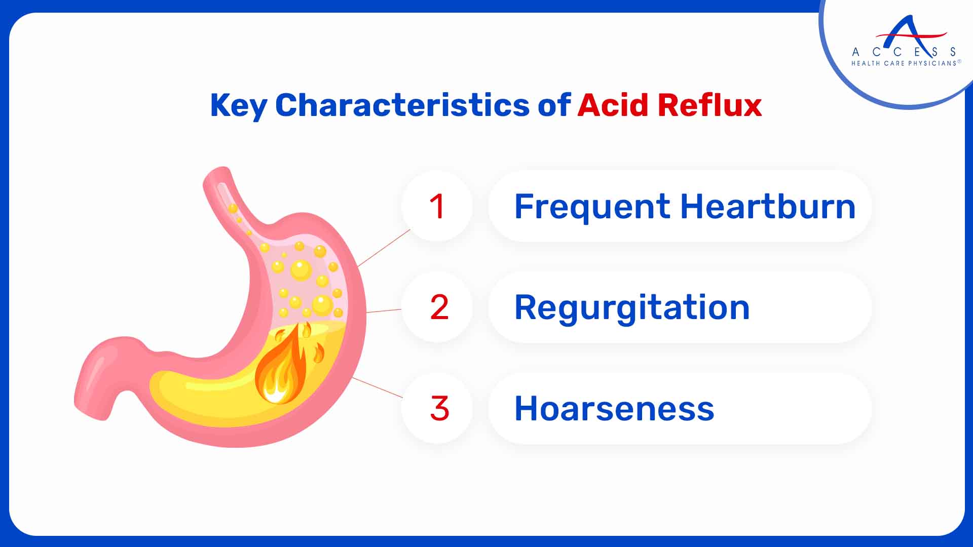 Key Characteristics of Acid Reflux