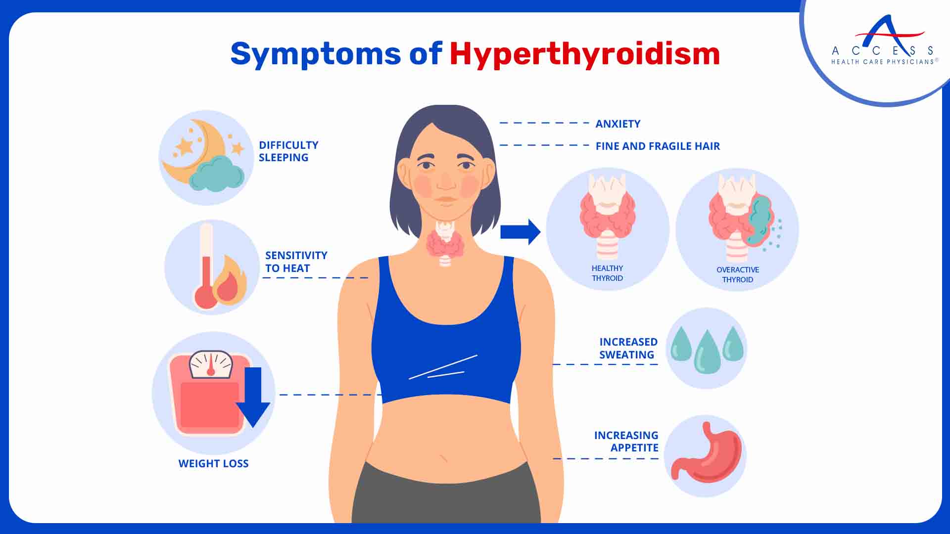 The symptoms of hyperthyroidism can vary in severity but often include