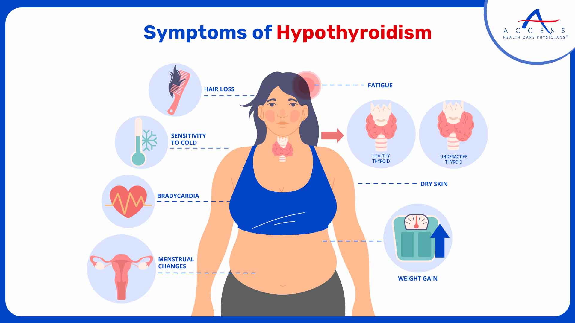 On the other hand, the symptoms of hypothyroidism can be subtle. Common symptoms include:
