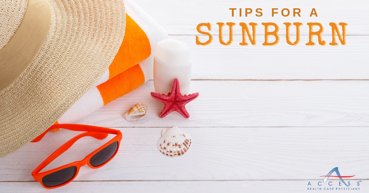 Tip To Deal With A Sunburn | Access Health Care Physicians