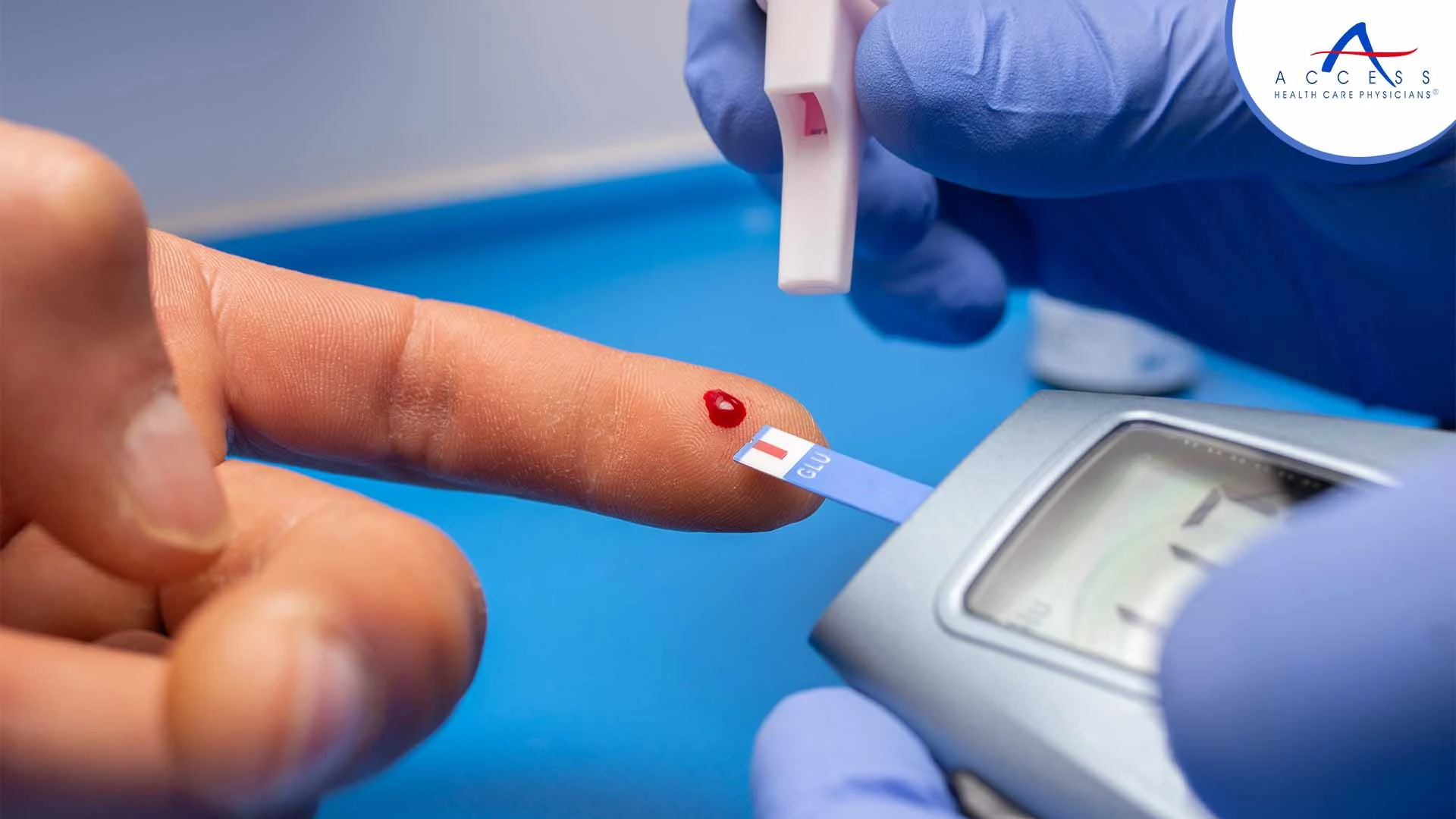 Understanding Hyperglycemia: Importance of Regular Blood Sugar Monitoring