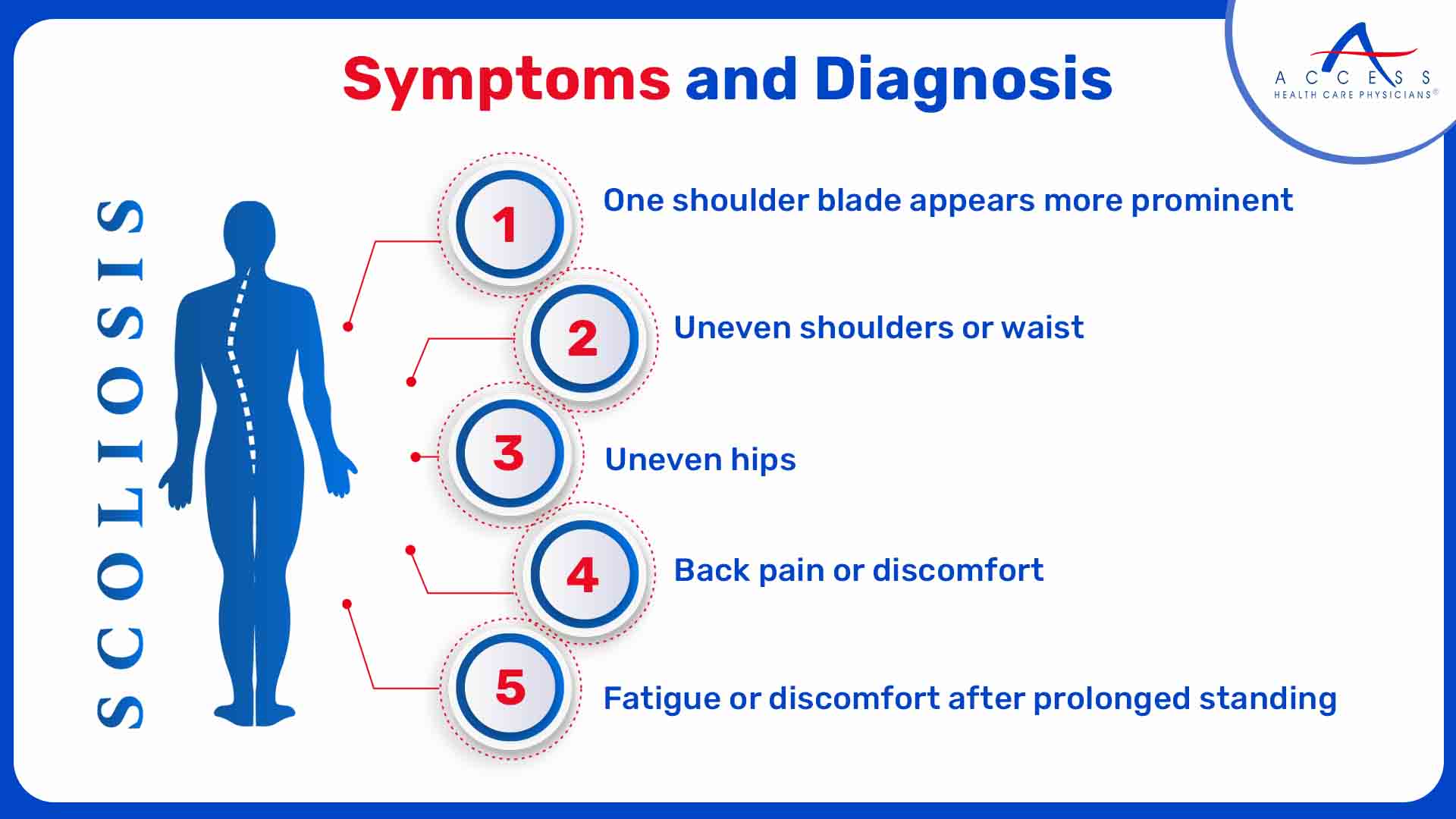 Scoliosis Symptoms and Diagnosis