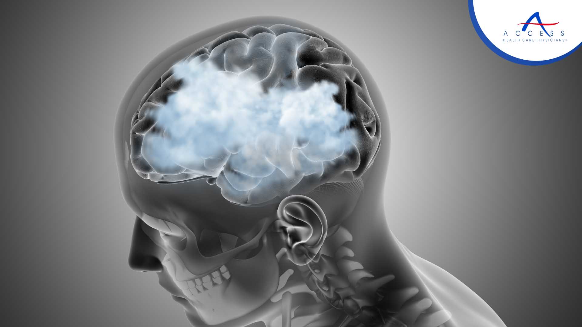 What is Brain Fog and how do you recover from it? 