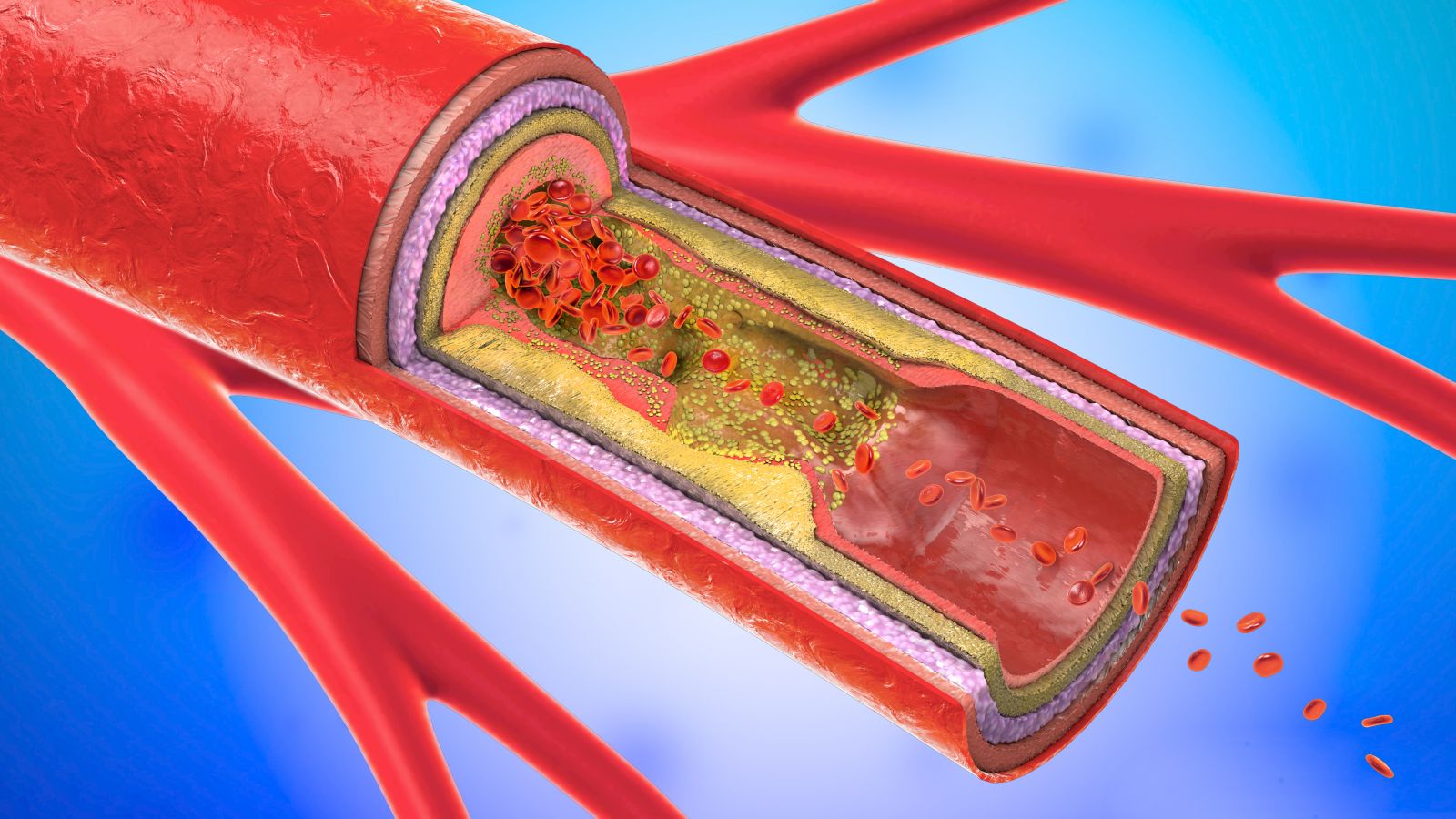 Know about carotid artery location & carotid artery testing with Access Health Care Physicians in Florida.